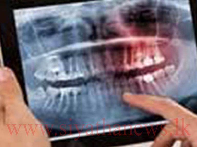 X-ray ඩිජිටල් වෙයි