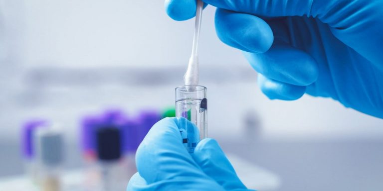දෛනික PCR පරීක්ෂණ සංඛ්‍යාව වැඩි කරයි