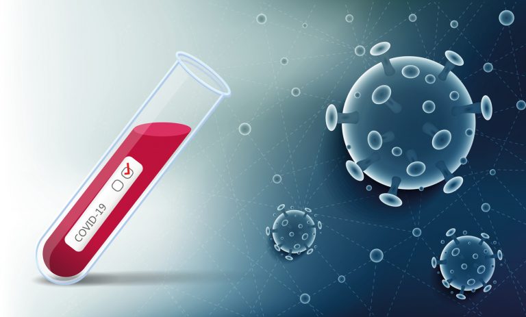 මෙරට කොවිඩ්-19 ආසාදිතයින් ගණන 2731 දක්වා ඉහළට