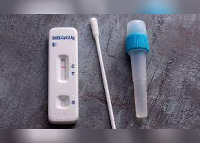 PCR සහ ඇන්ටිජන් පරීක්ෂණ සඳහා ඉදිරි සතියේ පාලන මිලක්