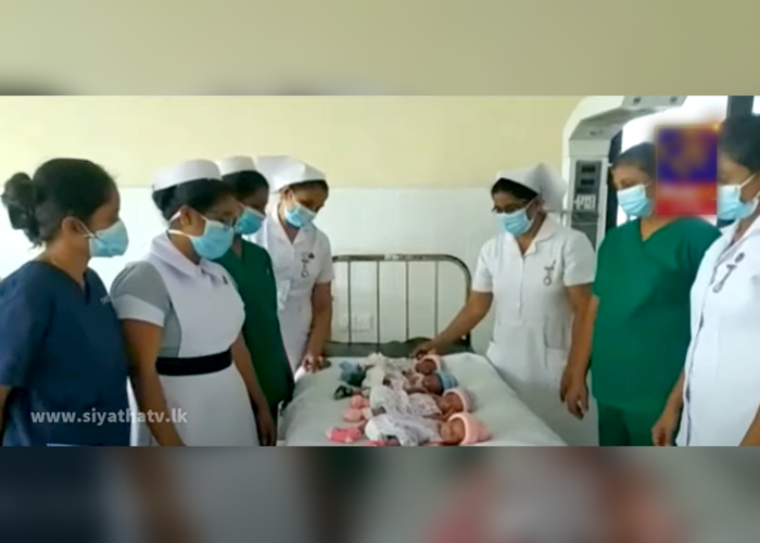 පුත්තලම රෝහලේ සිව් නිවුන් දරු උපතක්