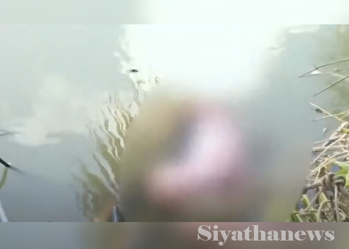 විශේෂ අවශ්‍යතා සහිත තරුණියකගේ සිරුරක් වගා ළිඳකින්