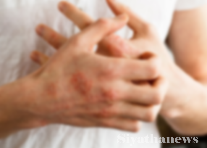 ලෝක එක්සීමා දිනය අදයි