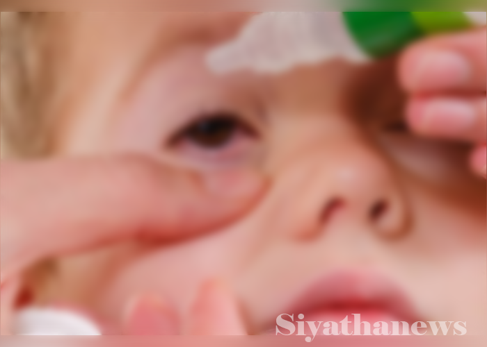 දරුවන් අතර ඇස් රෝගයේ සීඝ්‍ර පැතිරීමක්(VIDEO)