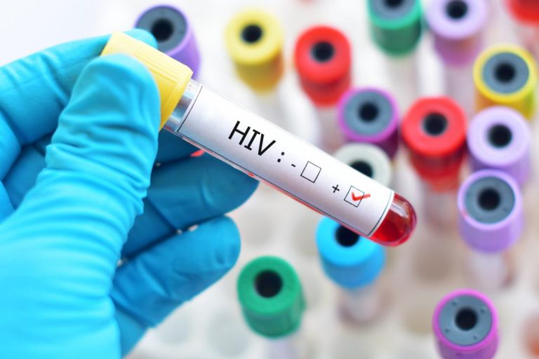 HIV ආසාදිතයින් ඉහළට – වැඩිම රෝගීන් බස්නාහිරින්