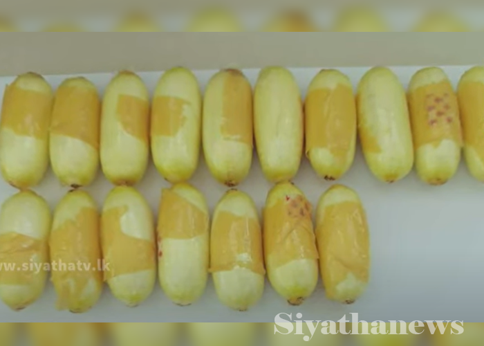 කොකේන් කරල් ගිල දැමූ විදේශිකයෙකු ගුවන් තොටුපළේදී කොටු (VIDEO)