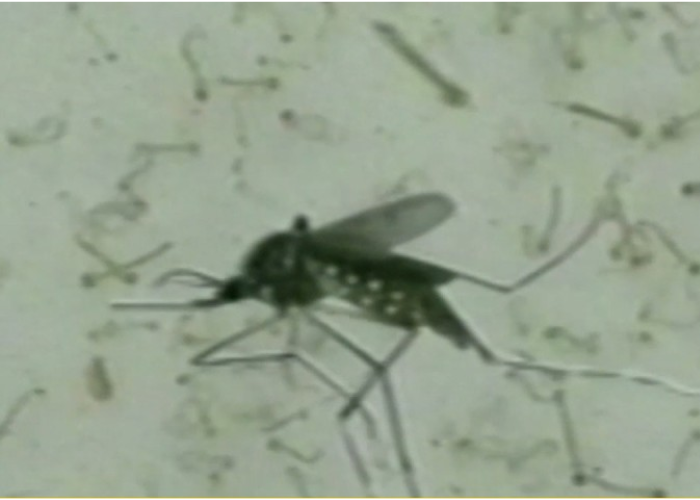 මාසෙට ඩෙංගු රෝගීන් 21,000 පනී (VIDEO)